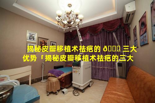 揭秘皮瓣移植术祛疤的 🐈 三大优势「揭秘皮瓣移植术祛疤的三大优 🌼 势是什么」